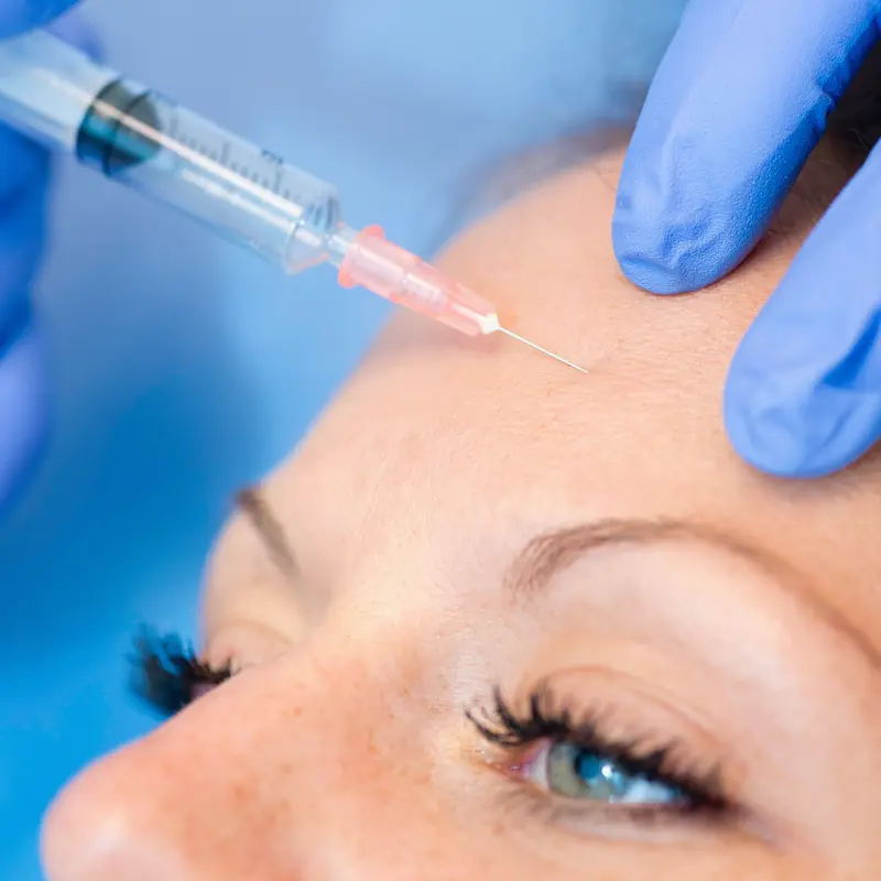 Botulino viso a Milano centro - Medicina estetica con botox